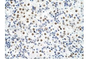 HNRPA3 antibody was used for immunohistochemistry at a concentration of 4-8 ug/ml to stain Hepatocytes (arrows) in Human Liver.