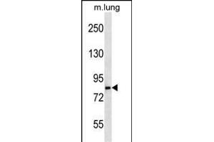 LRS Antibody (N-term) (ABIN656897 and ABIN2846096) western blot analysis in mouse lung tissue lysates (35 μg/lane). (LRSAM1 抗体  (N-Term))