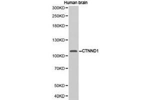 Western Blotting (WB) image for anti-Catenin (Cadherin-Associated Protein), delta 1 (CTNND1) antibody (ABIN1872087) (CTNND1 抗体)