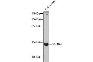 Western blot analysis of extracts of Rat spleen using S100A9 Polyclonal Antibody at dilution of 1:1000. (S100A9 抗体)