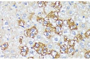 Immunohistochemistry of paraffin-embedded Rat liver using WNT1 Polyclonal Antibody at dilution of 1:100 (40x lens).