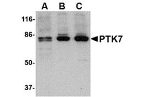 Image no. 1 for anti-PTK7 Protein tyrosine Kinase 7 (PTK7) (N-Term) antibody (ABIN318893) (PTK7 抗体  (N-Term))