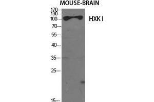 Western Blot (WB) analysis of specific cells using HXK I Polyclonal Antibody. (HXK I (N-Term) 抗体)