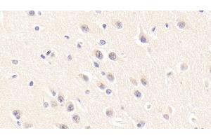 Immunohistochemistry (IHC) image for anti-Sirtuin 3 (SIRT3) (AA 126-399) antibody (ABIN7435922)