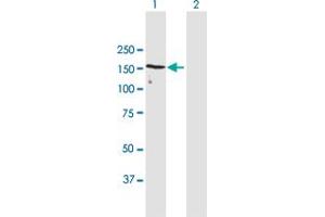 Western Blot analysis of UACA expression in transfected 293T cell line by UACA MaxPab polyclonal antibody. (UACA 抗体  (AA 1-1416))