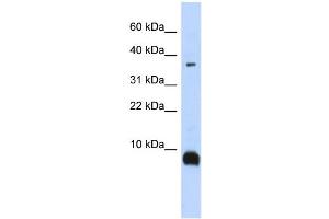 WB Suggested Anti-TAC3 Antibody Titration:  0. (Tachykinin 3 抗体  (Middle Region))