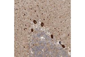 Immunohistochemical staining of human cerebellum with DNAH14 polyclonal antibody  shows strong cytoplasmic positivity in Purkinje cells. (DNAH14 抗体)
