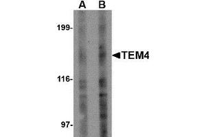 Western blot analysis of TEM4 in Jurkat Cell lysate with TEM4 antibody at (A) 1 and (B) 2 µg/ml. (ARHGEF17 抗体)