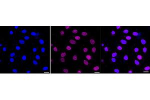anti-EPH Receptor B1 (EPHB1) antibody