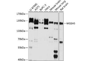 Western blot analysis of extracts of various cell lines, using MGE antibody (ABIN6132799, ABIN6143821, ABIN6143822 and ABIN6224867) at 1:1000 dilution. (MGEA5 抗体  (AA 380-580))