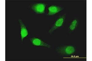 Immunofluorescence of monoclonal antibody to FOXO1 on HeLa cell. (FOXO1 抗体  (AA 452-555))