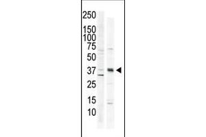 The anti-CK1 C-term Pab (ABIN391310 and ABIN2841344) is used in Western blot to detect CK1 in HeLa cell lysate (lane 1) and primate brain tissue lysate (lane 2). (CAMK1 抗体  (C-Term))