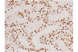 ABIN6267523 at 1/200 staining Rat kidney tissue sections by IHC-P. (SYK 抗体  (pTyr348))