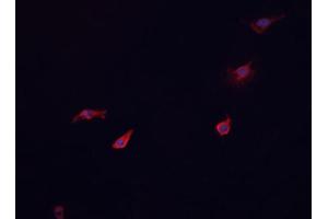 ABIN6268866 staining HeLa cells by IF/ICC. (Glucagon Receptor 抗体  (Internal Region))