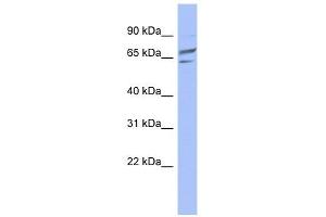 PGM1 antibody used at 1 ug/ml to detect target protein. (Phosphoglucomutase 1 抗体  (Middle Region))