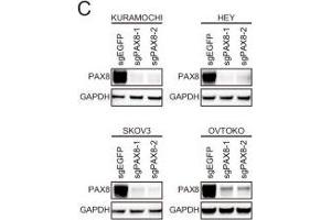 Western Blotting (WB) image for anti-Paired Box 8 (PAX8) antibody (ABIN2855097)