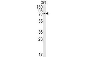 Image no. 1 for anti-Bone Morphogenetic Protein Receptor 1A (BMPR1A) (N-Term) antibody (ABIN357374) (BMPR1A 抗体  (N-Term))