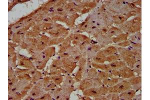 IHC image of ABIN7148294 diluted at 1:500 and staining in paraffin-embedded human heart tissue performed on a Leica BondTM system. (MCC 抗体  (AA 479-611))