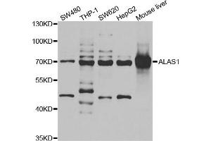 Western blot analysis of extracts of various cell lines, using ALAS1 antibody. (ALAS1 抗体)