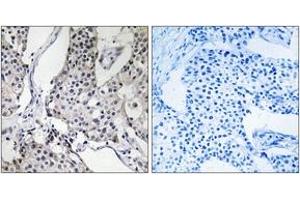 Immunohistochemistry (IHC) image for anti-Pleckstrin Homology-Like Domain, Family A, Member 3 (PHLDA3) (AA 21-70) antibody (ABIN1534482)