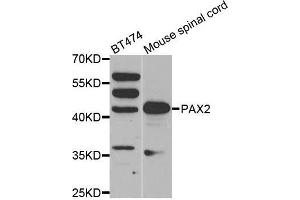 Western blot analysis of extracts of various cell lines, using PAX2 antibody. (PAX2A 抗体)