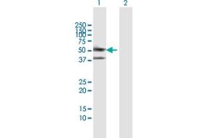 Western Blot analysis of SERPINA3 expression in transfected 293T cell line by SERPINA3 MaxPab polyclonal antibody. (SERPINA3 抗体  (AA 1-423))