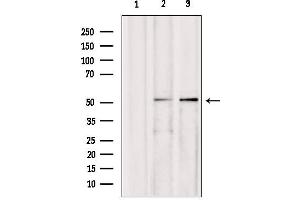 Western blot analysis of extracts from various samples, using AEBP2 antibody. (AEBP2 抗体  (Internal Region))