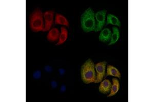 ABIN6257117 and ABIN6275043 staining Hela cells by IF/ICC. (GARP 抗体  (Internal Region))