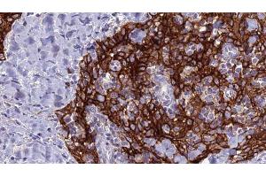 Immunohistochemistry (IHC) image for anti-Solute Carrier Family 4, Sodium Bicarbonate Cotransporter, Member 9 (SLC4A9) antibody (ABIN6265138)