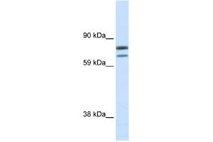 WB Suggested Anti-ZFPM1 Antibody Titration:  0. (ZFPM1 抗体  (N-Term))