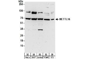 anti-Methyltransferase Like 16 (METTL16) (AA 375-425) antibody
