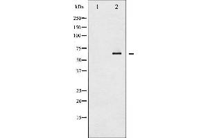Western blot analysis of SYK expression in UV treated K562 whole cell lysates,The lane on the left is treated with the antigen-specific peptide. (SYK 抗体)