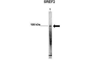 WB Suggested Anti-SREBF2 Antibody    Positive Control:  Lane 1: 50ug mouse glomerular endothelial lysate   Primary Antibody Dilution :   1:1000   Secondary Antibody :  Anti-rabbit-HRP   Secondry Antibody Dilution :   1:5000   Submitted by:  Xiaoxin Wang, UC Denver (SREBF2 抗体  (Middle Region))