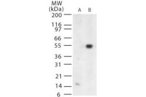 Image no. 1 for anti-West Nile Virus (WNV) (AA 73-86) antibody (ABIN199990) (West Nile Virus 抗体  (AA 73-86))