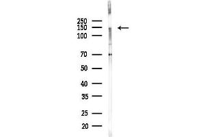 Western blot analysis of lysates from HepG2 cells(starvation,24h treatment), using TRIM66 Antibody at 1/1000 dilution.