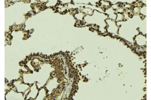 ABIN6268967 at 1/100 staining Mouse lung tissue by IHC-P. (DAXX 抗体  (C-Term))