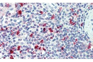 Immunohistochemistry (IHC) image for anti-Triggering Receptor Expressed On Myeloid Cells 2 (TREM2) (AA 1-228) antibody (ABIN7443632)