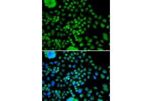Immunofluorescence analysis of MCF7 cell using ATOH7 antibody. (ATOH7 抗体)