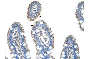Immunohistochemistry (IHC) image for anti-Solute Carrier Family 22 (Organic Cation Transporter), Member 1 (SLC22A1) antibody (ABIN630309)