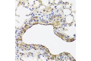 Immunohistochemistry of paraffin-embedded mouse lung using TOMM34 antibody (ABIN5972523) at dilution of 1/100 (40x lens). (TOMM34 抗体)