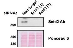 Western blot testing of mouse fibroblast lysates transiently expressing unrelated and two different siRNA with SETD2 antibody at 0. (SETD2 抗体)