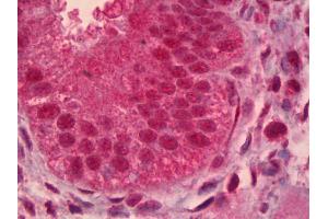 Anti-PAX9 antibody IHC of human uterus, endometrium. (PAX9 抗体)