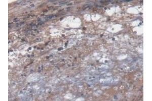 Detection of GLRX3 in Mouse Small intestine Tissue using Polyclonal Antibody to Glutaredoxin 3 (GLRX3)