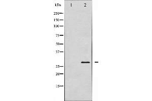 Western blot analysis of TNNI3 expression in Mouse hearttissue lysates,The lane on the left is treated with the antigen-specific peptide. (TNNI3 抗体)