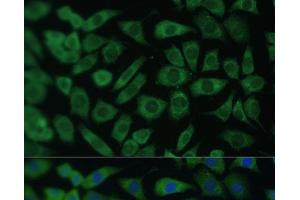 Immunofluorescence analysis of L929 cells using ARL3 Polyclonal Antibody at dilution of 1:100 (40x lens). (ARL3 抗体)