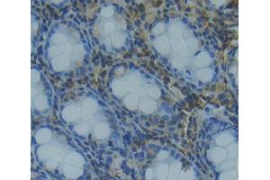 Used in DAB staining on fromalin fixed paraffin- embedded rectum tissue (TCEB1 抗体  (AA 1-112))