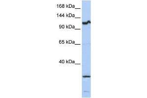 Western Blotting (WB) image for anti-Oncostatin M Receptor (OSMR) antibody (ABIN2459017) (Oncostatin M Receptor 抗体)