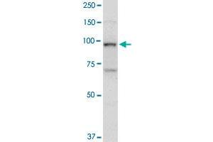 TOP1 monoclonal antibody (M01), clone 1A1. (Topoisomerase I 抗体  (AA 692-765))