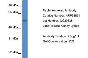 Western Blotting (WB) image for anti-Arylsulfatase B (ARSB) (Middle Region) antibody (ABIN786015) (Arylsulfatase B 抗体  (Middle Region))