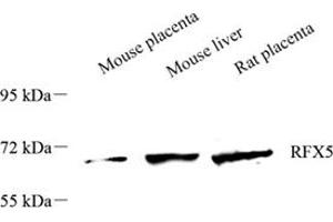 Western blot analysis of RFX5 (ABIN7075399),at dilution of 1: 1500 (RFX5 抗体)